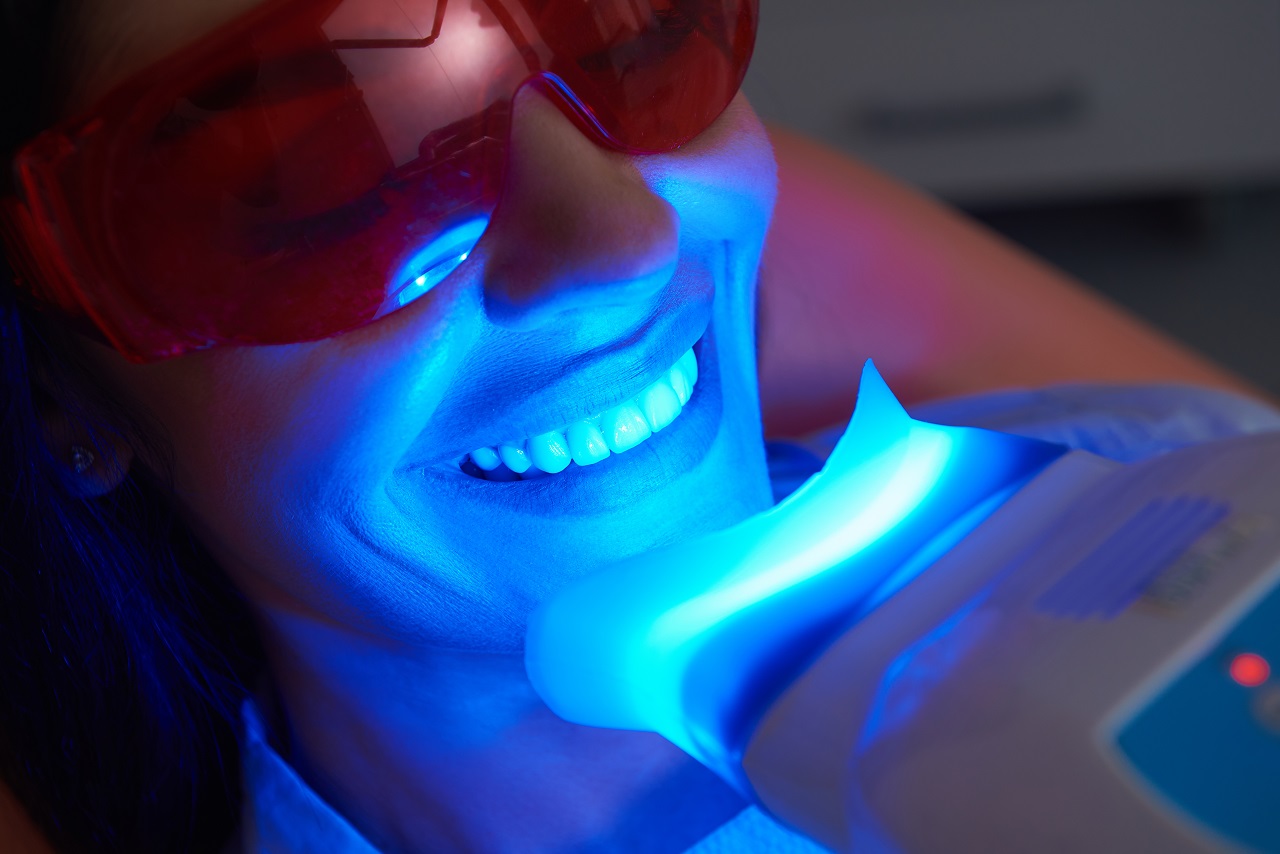 Metody wybielania zębów – na którą warto się zdecydować?